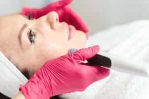 Woman smiles during microneedling treatment