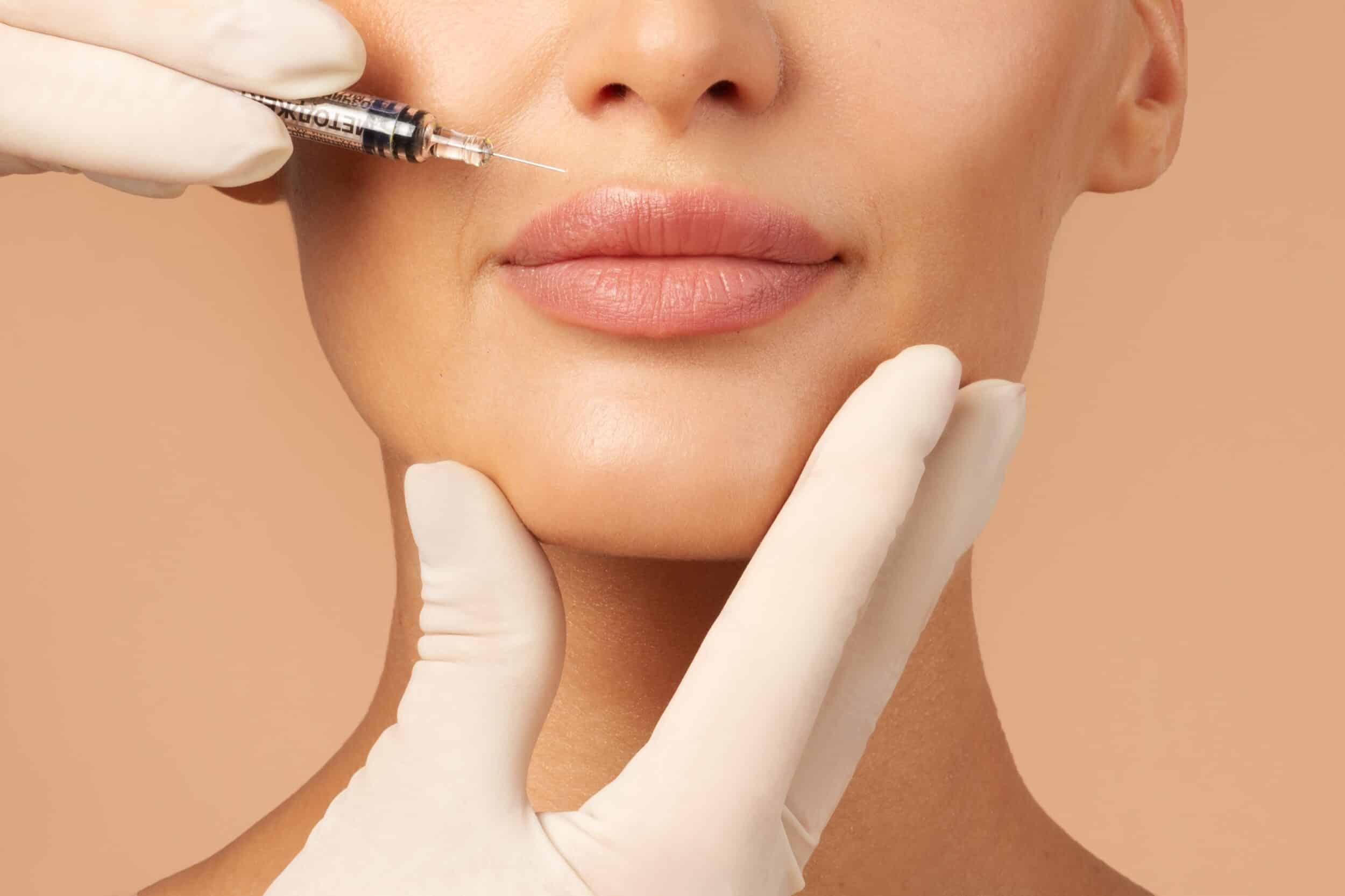 Woman receives dermal filler injections in her lips